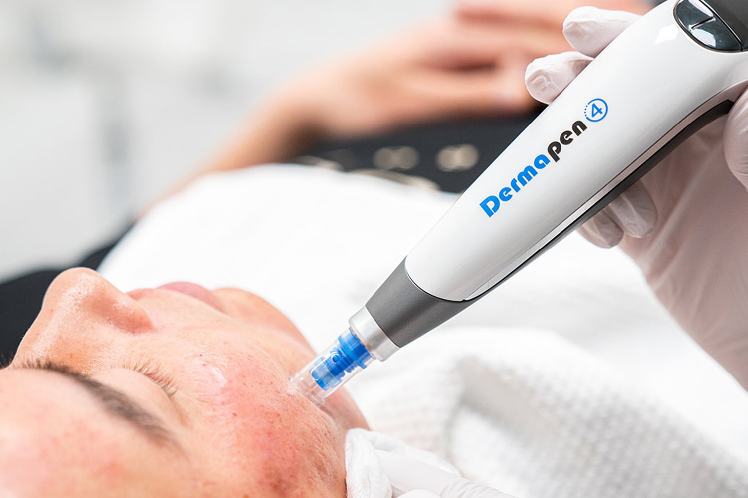 Dermapen